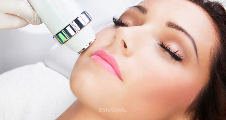 luz pulsada para rostro en cordoba